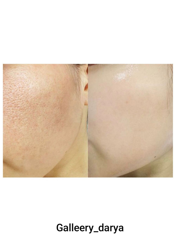 ماسک و اسکراب صورت هلویی با لایه برداری عالی پوست بیوآکوا