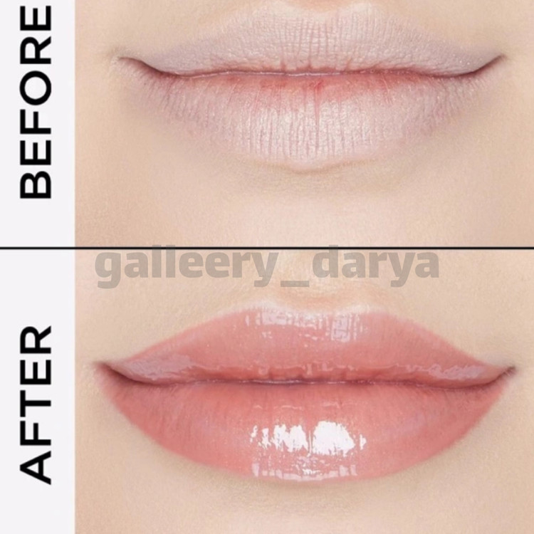 قبل و بعد استفاده از بالم لب گابرینی Gabrinia