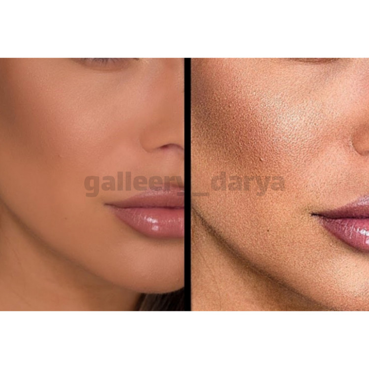 قبل و بعد استفاده از کرم مناسب بیواستار biostar. مات مخملی