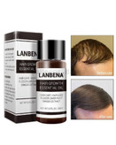 روغن تقویت کننده مو برند لانبنا اصل