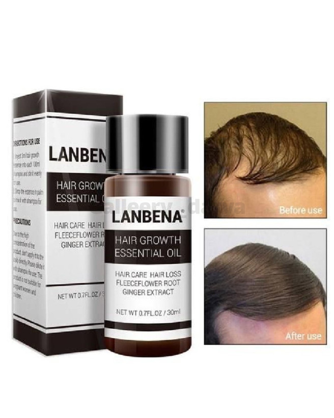 روغن تقویت کننده مو برند لانبنا اصل