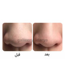 خرید آنلاین و اینترنتی چسب بینی سه مرحلهای بیوآکوا BIOAQUA از برنده جوش های سرسیاه با کیفیتی بالا و قیمت مناسب در سایت آرایشی بهداشتی گالری دریا